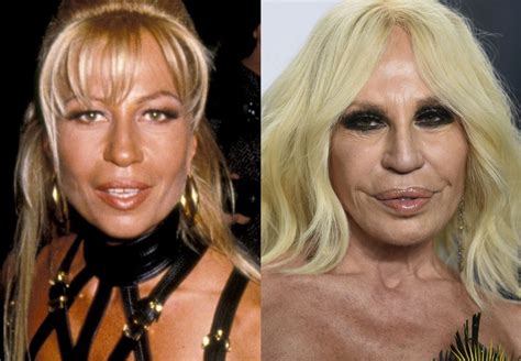 versace donatella antes y despues|donatella versace anterior y posterior.